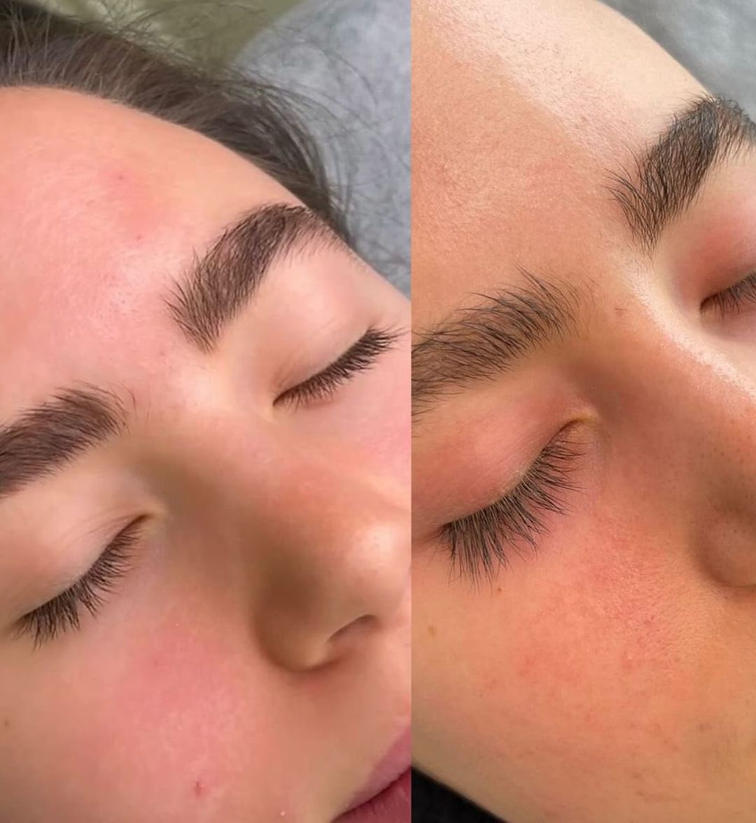 BLACKLASHES / Sérum cils